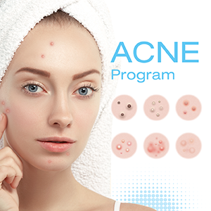 รูป บาร์ homepage_Acne